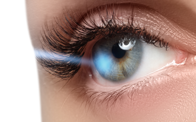 How to Prepare for Glaucoma Surgery