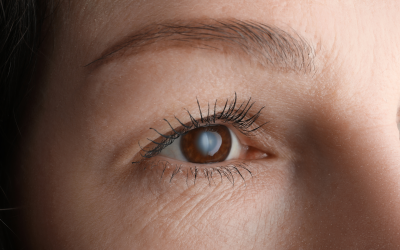 Why Should You Choose a Local Eye Surgery Clinic